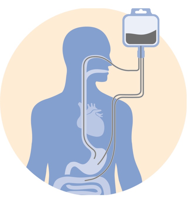 Dinh dưỡng qua ống thông